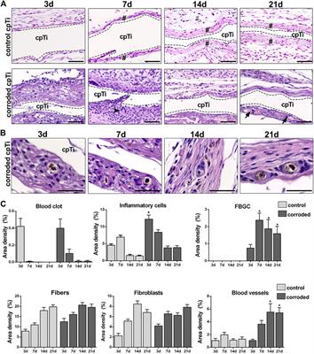 Effects of Titanium Corrosion Products on In Vivo Biological Response: A Basis for the Understanding of Osseointegration Failures Mechanisms